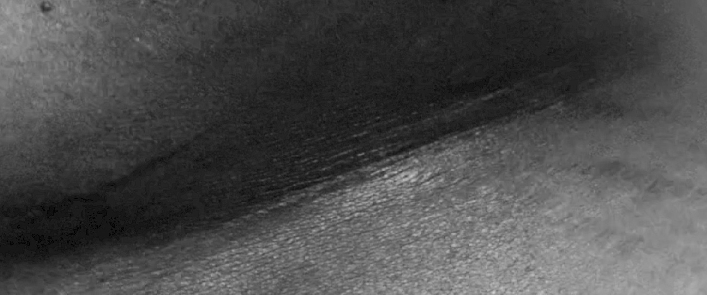 Shala Miller, Scar Light, 2025, Filmstill © Shala Miller Eine detaillierte Schwarz-Weiß-Nahaufnahme zeigt die Haut einer Person mit Schatten und Narben.