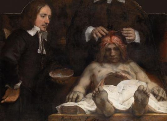 Gemälde einer liegendem Mann mit offenem Bauch, bei dem der Kopf von einer Person seziert wird, ein weiterer Mann rechts im Bild schaut zu